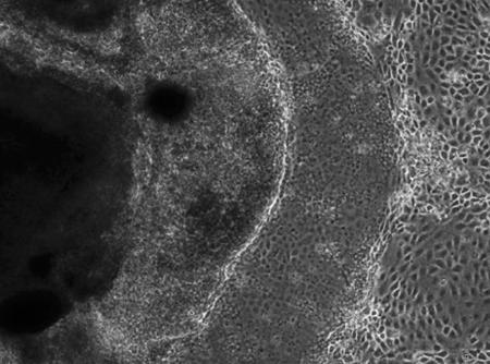 人のｉＰＳ細胞から作製した、目の主要な細胞を含んだ同心円状の４層の組織