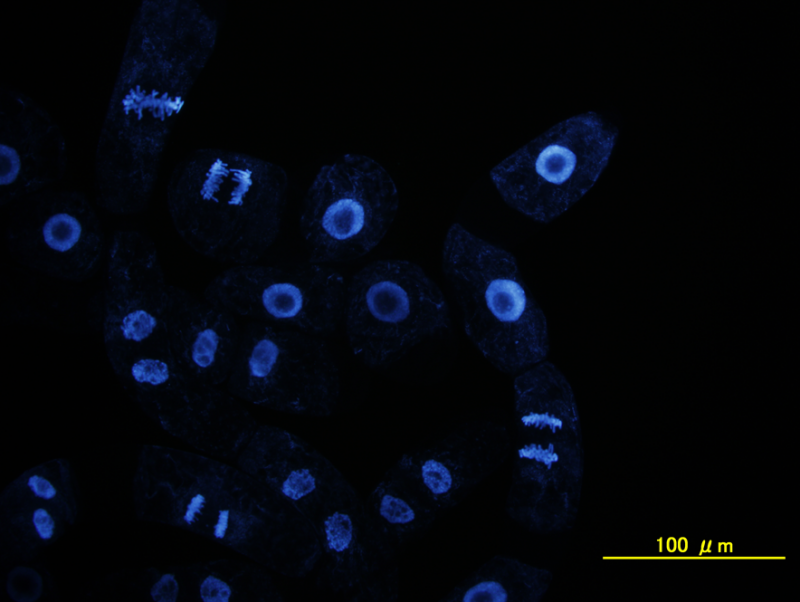 特殊な顕微鏡で観察した植物細胞のDNA